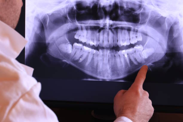Best Emergency Tooth Extraction  in Whitesboro, TX